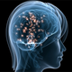 Illustration for article titled Depression May Up Women's Stroke Risk